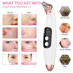 Blackhead Remover