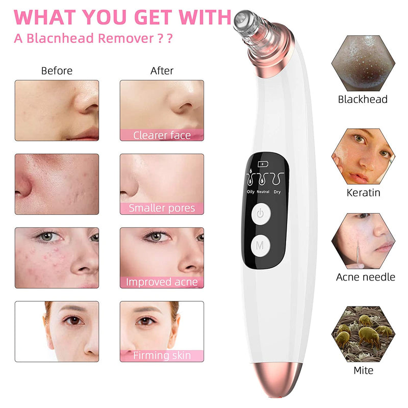 Blackhead Remover